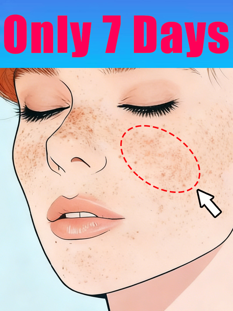 Luxury Skincare Cream - Lightening Facial Freckles Melasma Dark Spots